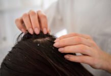 Como prevenir e tratar a caspa Cuidados simples ajudam a evitar a caspa e melhorar a saúde do couro cabeludo (Foto: Freepik)