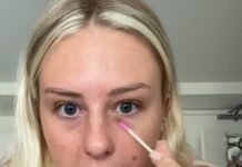 Viral do TikTok: Usar colírio para suavizar espinhas pode dar alergia e irritação na pele