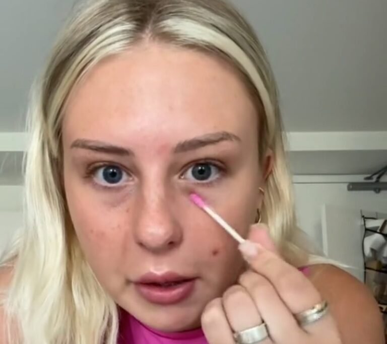 Viral do TikTok: Usar colírio para suavizar espinhas pode dar alergia e irritação na pele