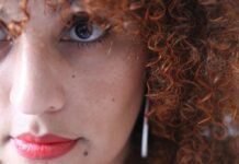 Melasma: União de cuidados preventivos e laser é fundamental para controlar as manchas escuras O melasma é uma das condições dermatológicas mais comuns no Brasil, afetando cerca de 35% das mulheres (Foto: Taisa Anjos por Pixabay)